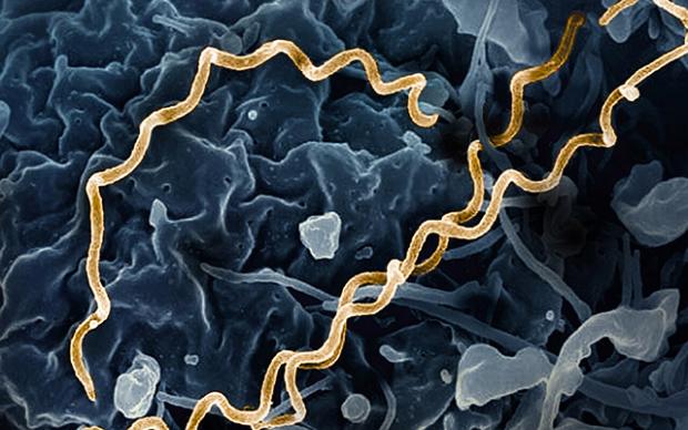 Electron micrograph image of T. pallidum, highlighted in gold