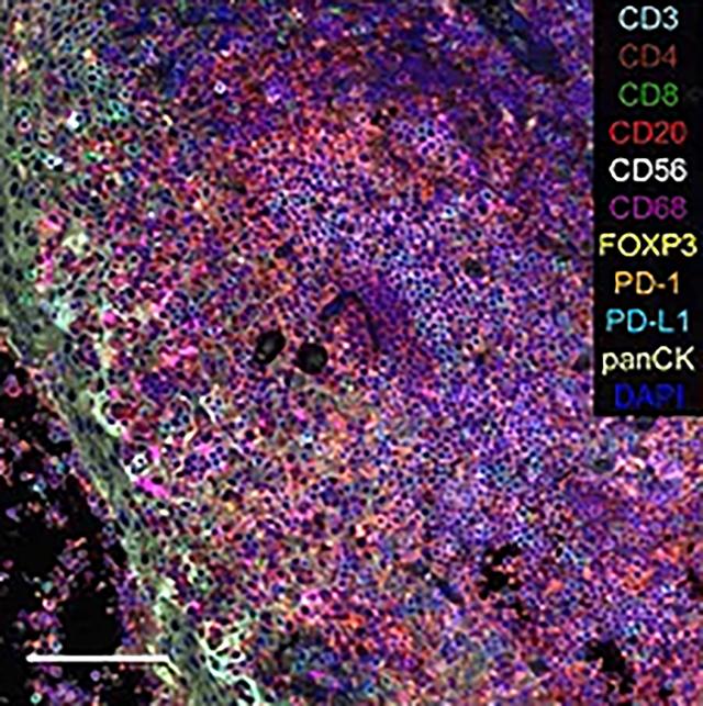 an image of a tissue with different colors on it